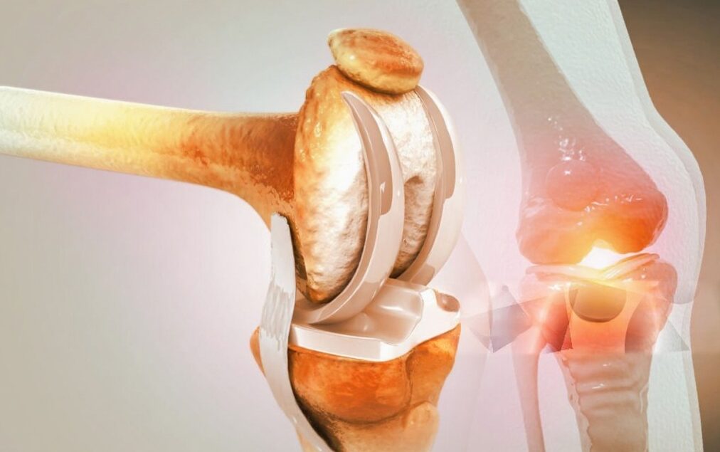 Orthopedics Department